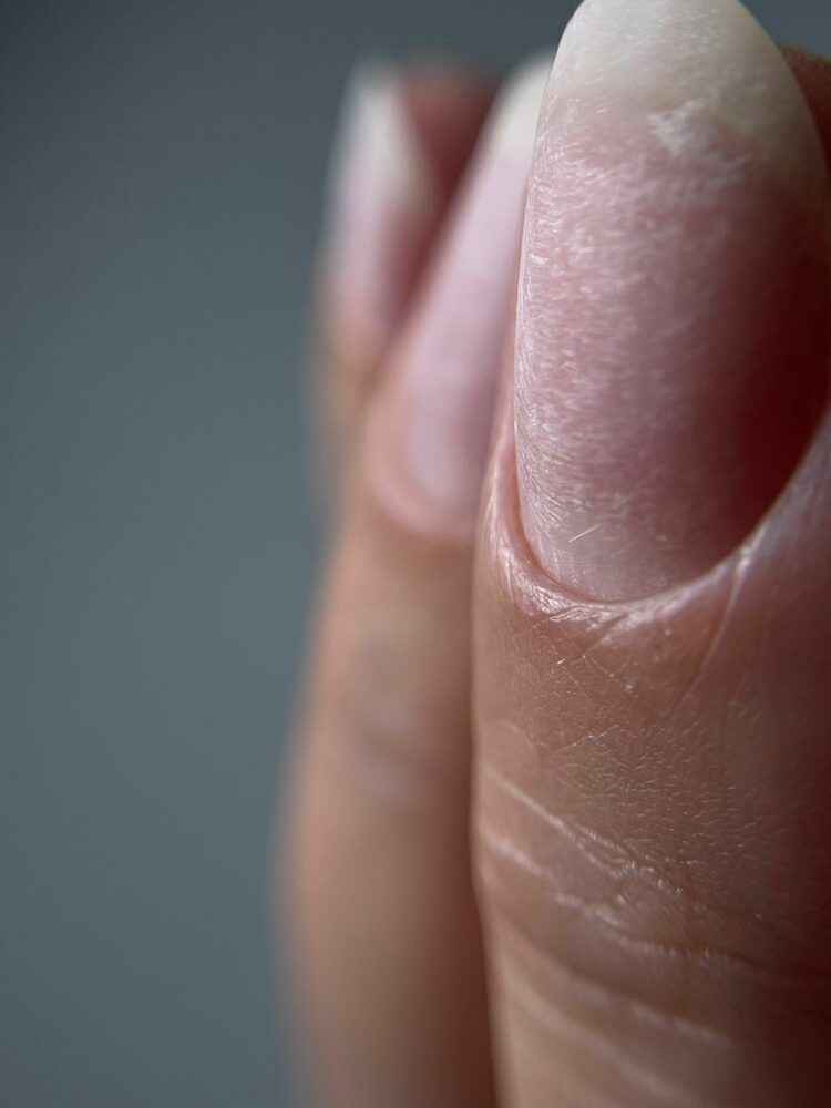 Portfolio usługi Opiłowanie paznokci z wycięciem skórek