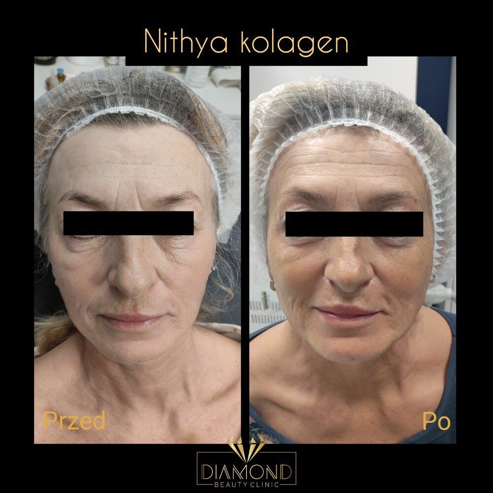 Portfolio usługi Nithya ( twarz + szyja + dekolt / dłonie)