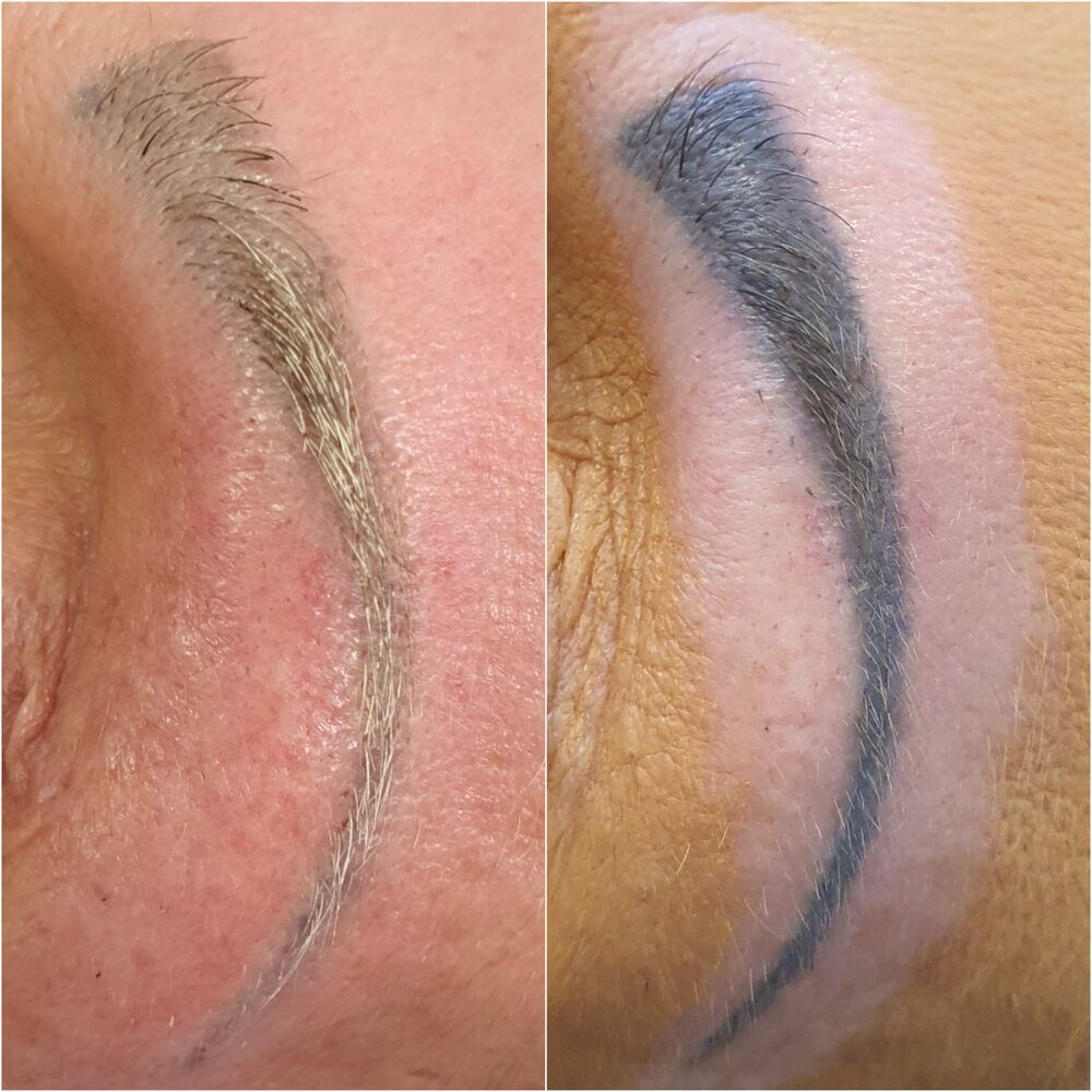 Portfolio usługi Usuwanie makijażu permanentnego brwi laserem