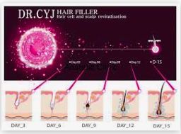 Portfolio usługi Mezoterapia skóry głowy i włosów DR. CYJ Hair F...