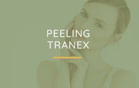 Portfolio usługi PEELING TRANEX