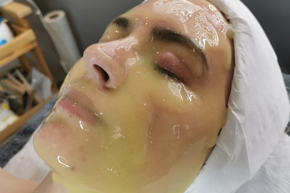 Microneedling full face + ampoule, hydrojelly mask portfolio