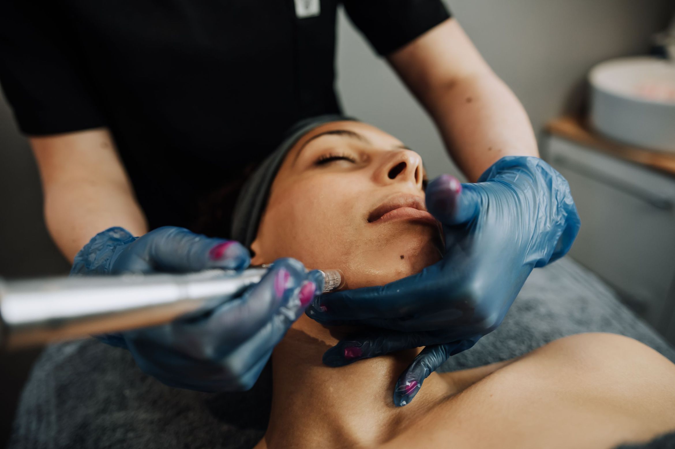 Microneedling face & neck + ampoule & hydrojelly portfolio
