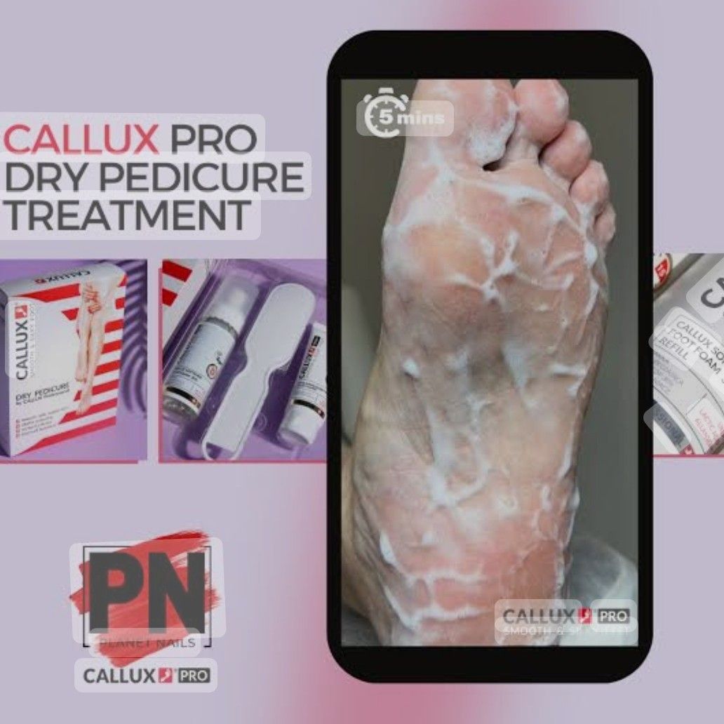 Callux Foot Peel 30% portfolio