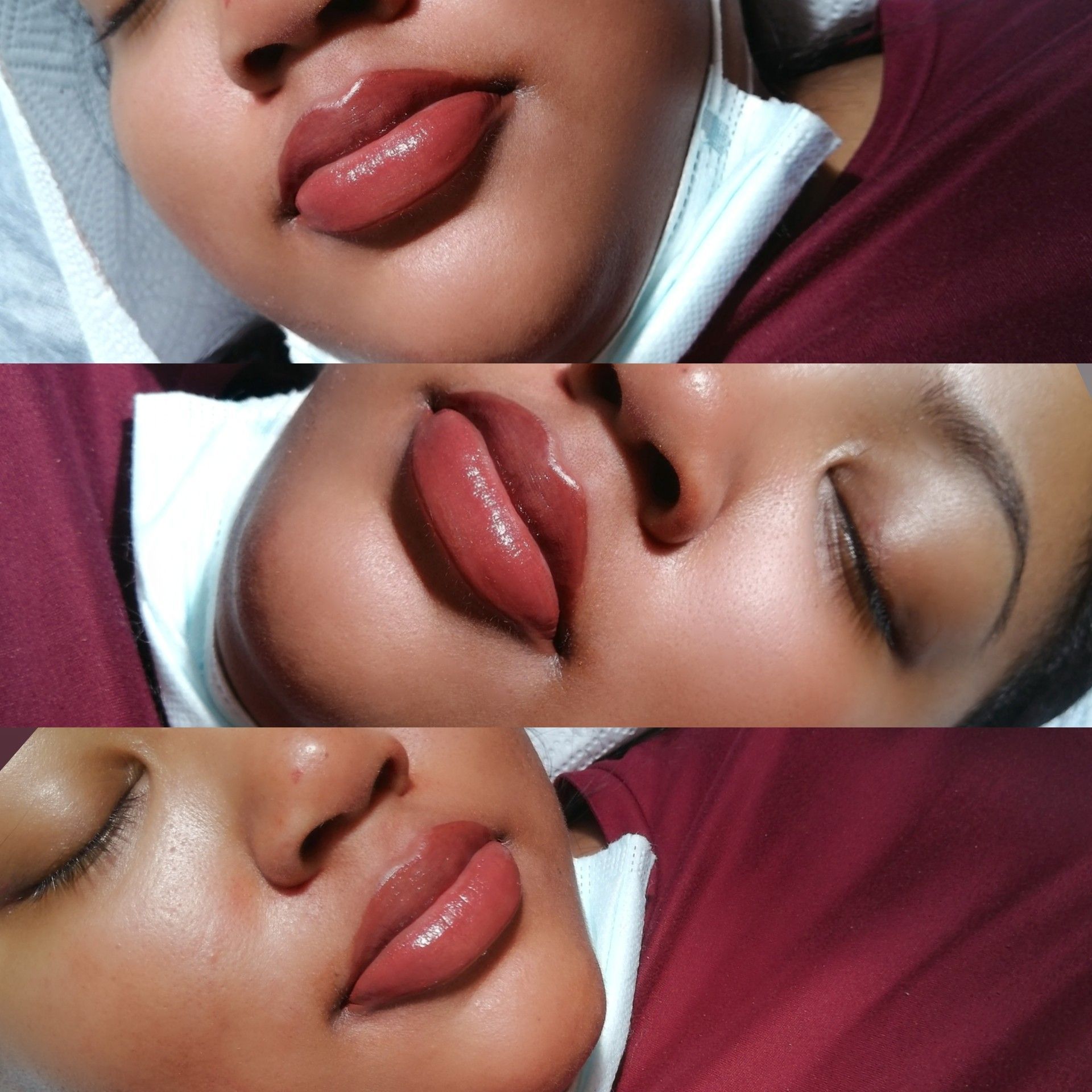 Full vibrant lips portfolio